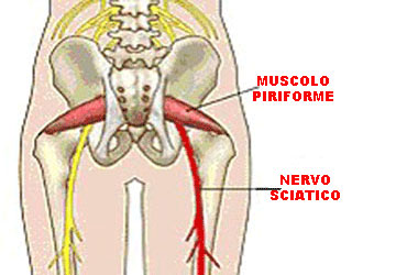 muscolo piriforme